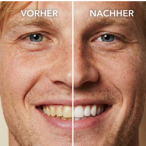 Tooth Polish - Instant Clean Smile
